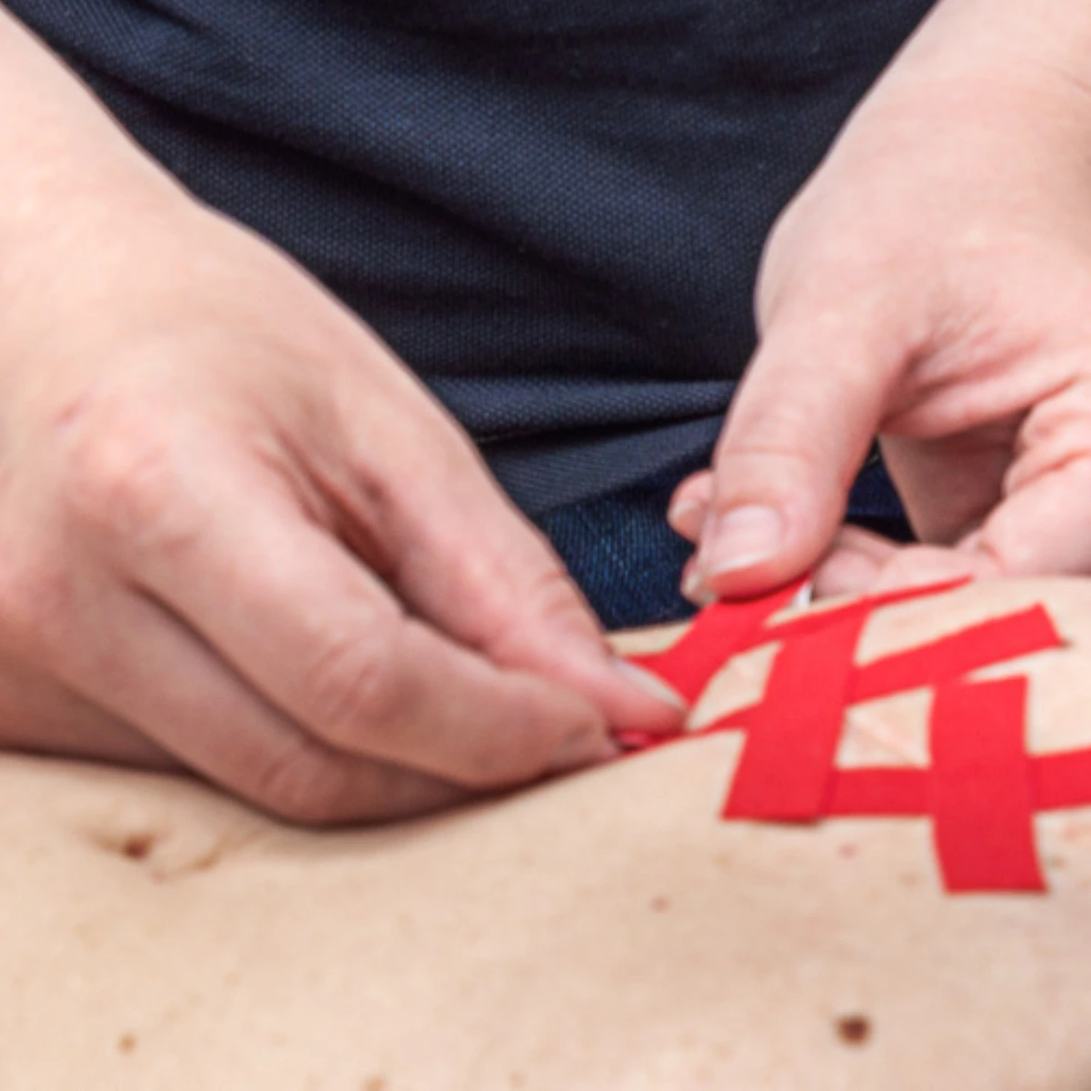Littekenbehandeling fysiotherapie NP (3)